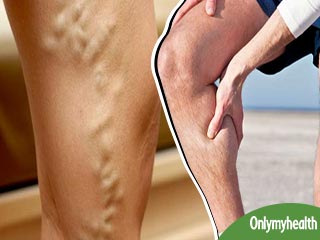 रोजाना की इन 5 आदतों से बढ़ जाता है नसों में सूजन का खतरा